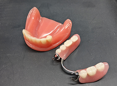 デンチャーインワンの魅力