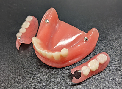 参考症例（模型解説）