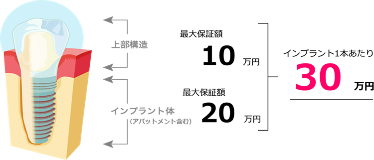 保証対象範囲